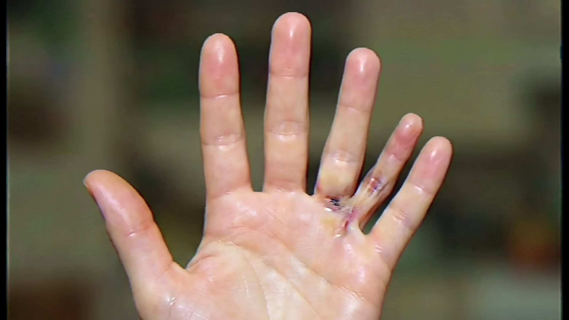 Una mano generada por computadora con un dedo de más